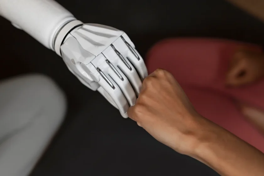 Life with an arm amputation: What to expect in rehab!
